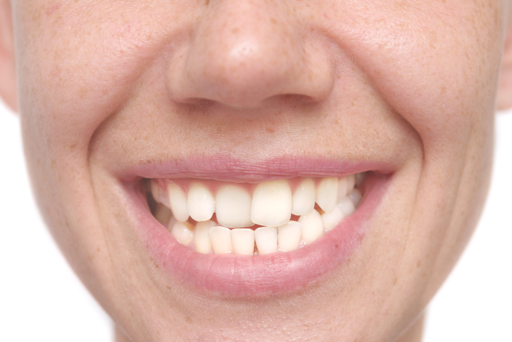 Close-up of a person's mouth and nose, showing a natural smile with teeth visible.