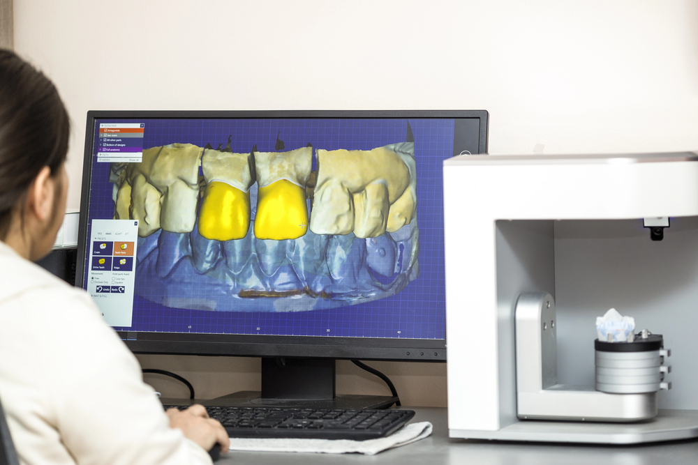 A person views a computer screen displaying a 3D dental model with highlighted yellow teeth, next to a dental scanner on a desk.