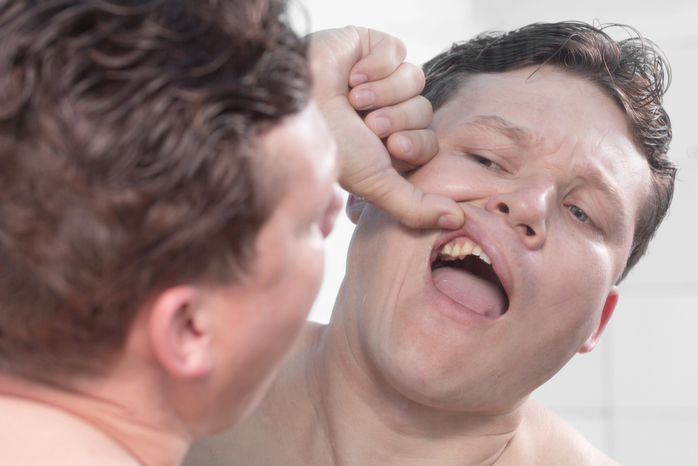A man stands in front of a mirror, pulling back his upper lip with his finger to examine his teeth and gums.